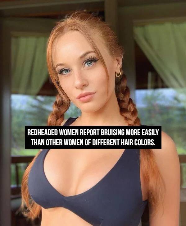 Flaming Facts About Redheads