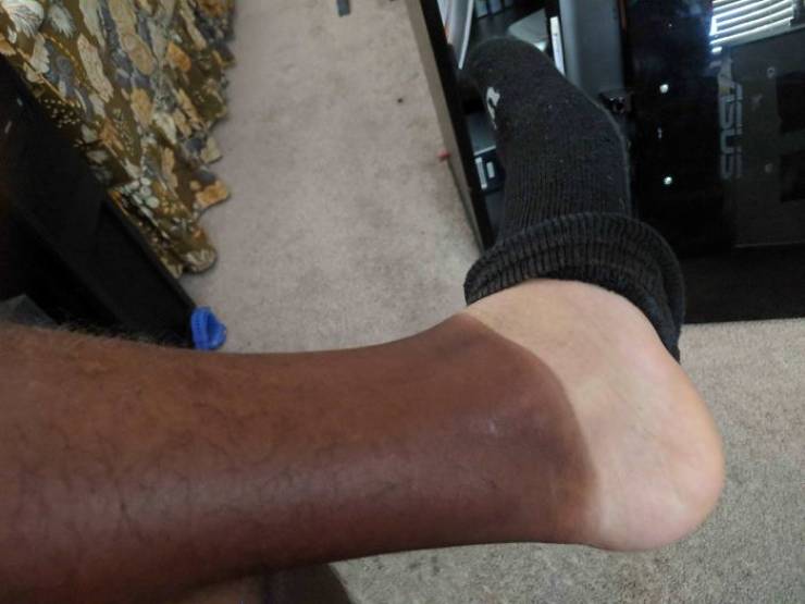 Never Forget Sunscreen!