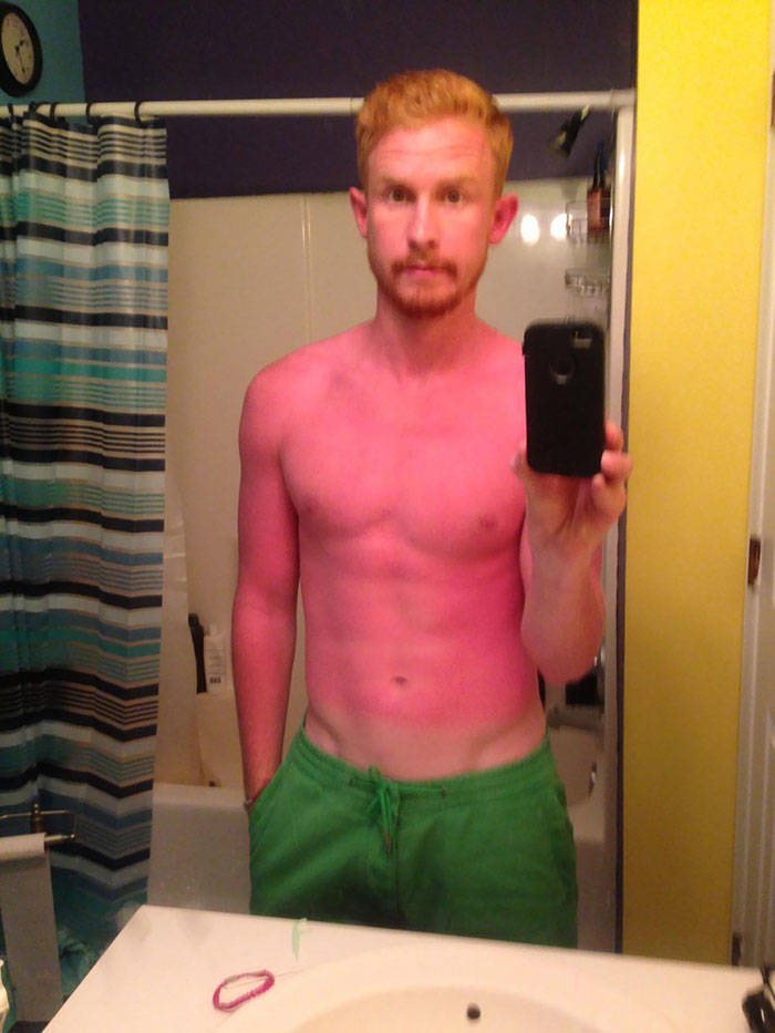 Never Forget Sunscreen!