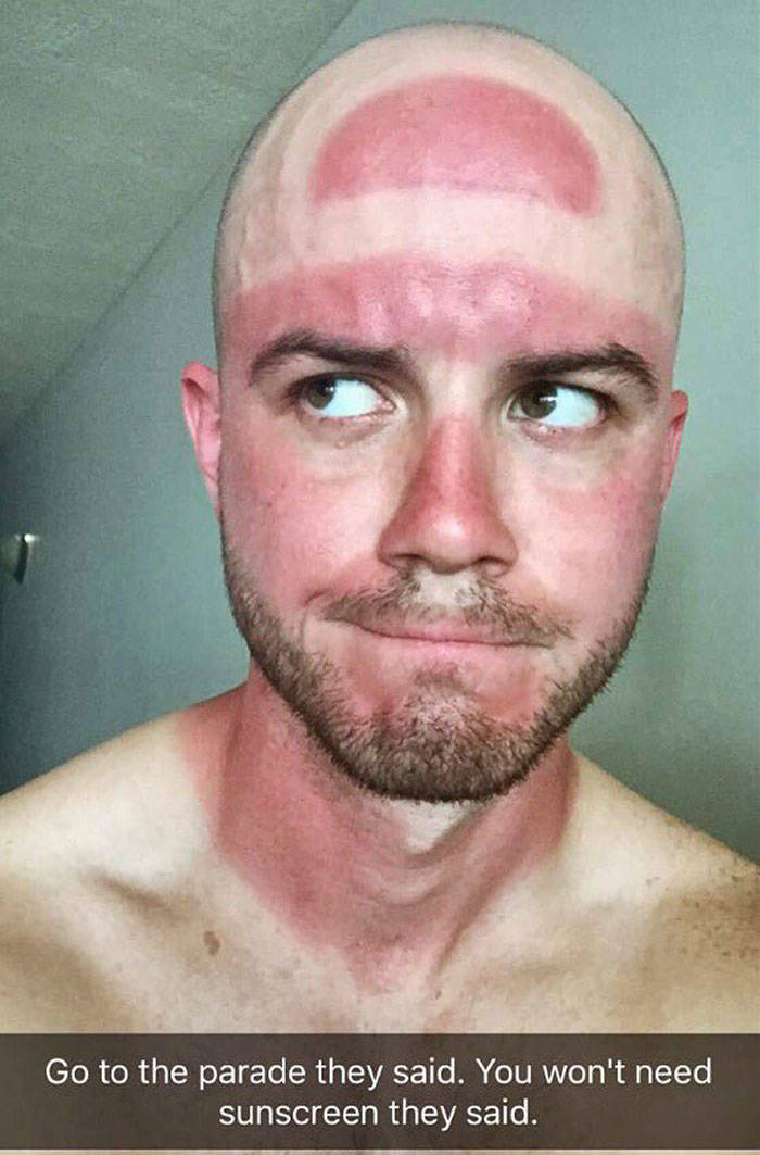 Never Forget Sunscreen!