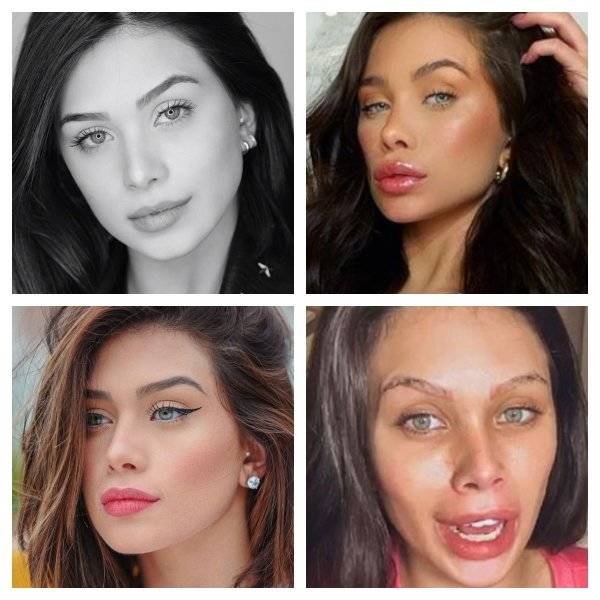 Plastic Surgery Is DEFINITELY Not For Everyone…