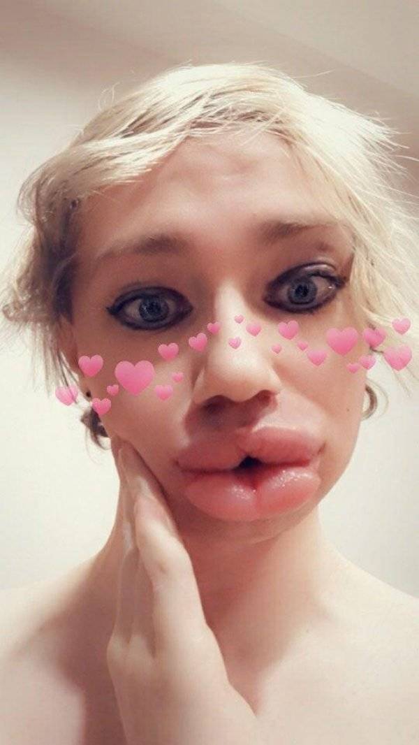 Plastic Surgery Is DEFINITELY Not For Everyone…