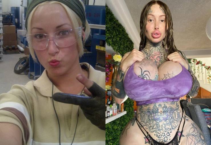 Plastic Surgery Fanatic Revealed Her Pre-Surgery Photos