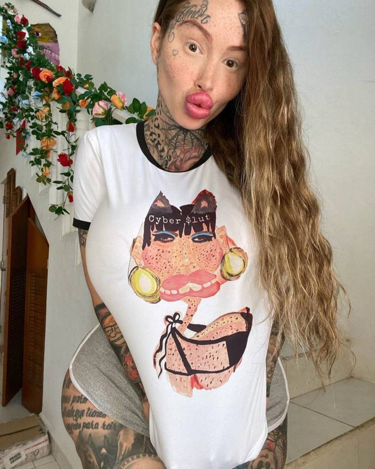 Plastic Surgery Fanatic Revealed Her Pre-Surgery Photos