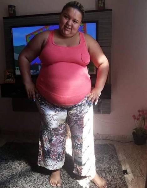 Impressive Transformation: From 140 To 70 Kg