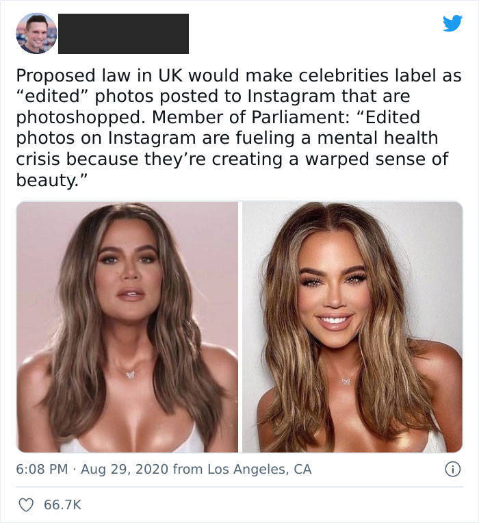 People Showing Their Real, Unedited Beauty