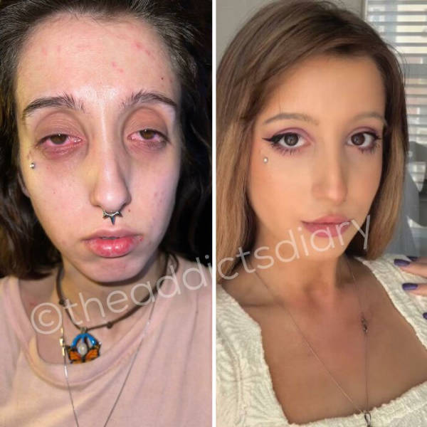 Former Drug Addicts Share Their Recovery Stories