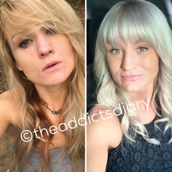 Former Drug Addicts Share Their Recovery Stories