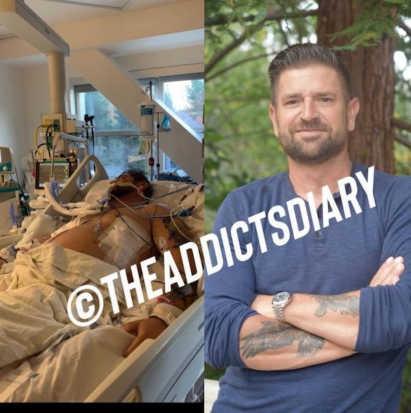 Incredibly Inspiring Drug Addict Transformations!