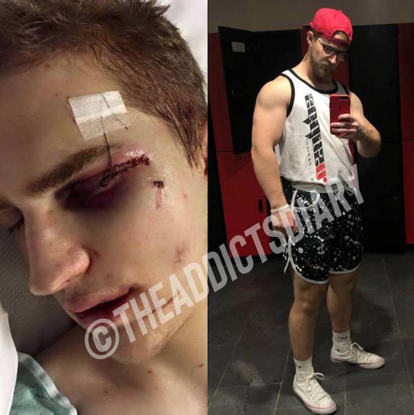 Incredibly Inspiring Drug Addict Transformations!