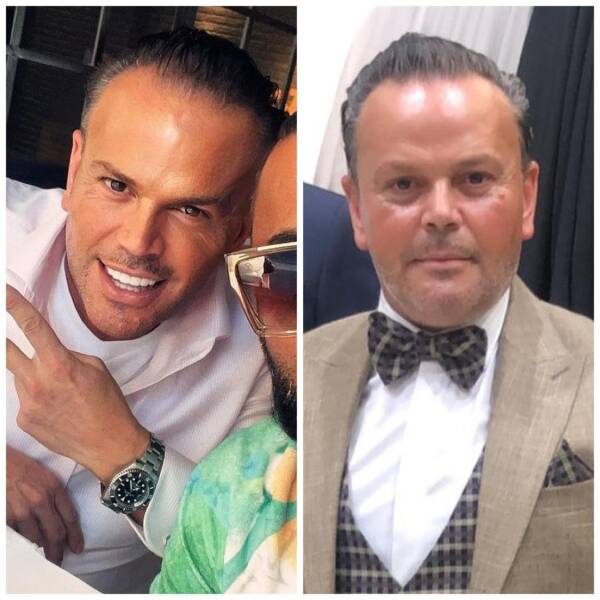 Photo Editing Is Bad For Their Mental Health…