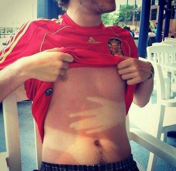 When Sunbathing Goes Wrong…