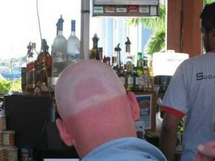When Sunbathing Goes Wrong…