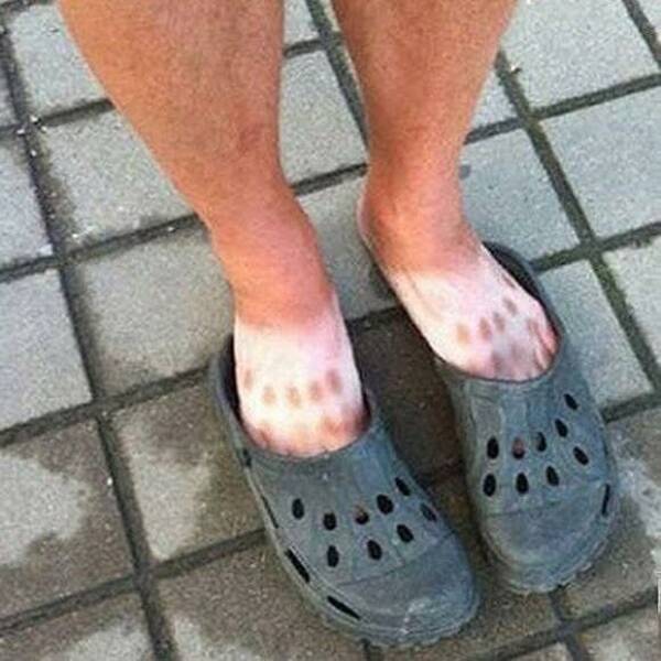 When Sunbathing Goes Wrong…