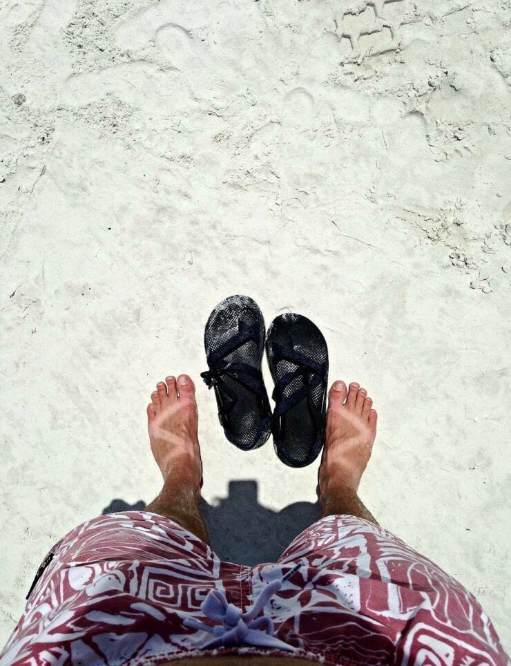 When Sunbathing Goes Wrong…