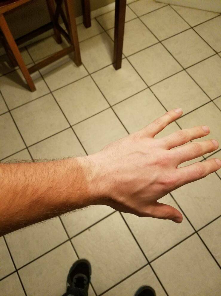 When Sunbathing Goes Wrong…