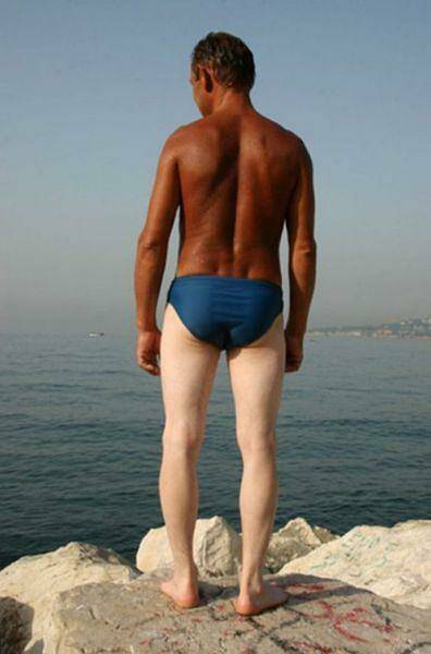 When Sunbathing Goes Wrong…