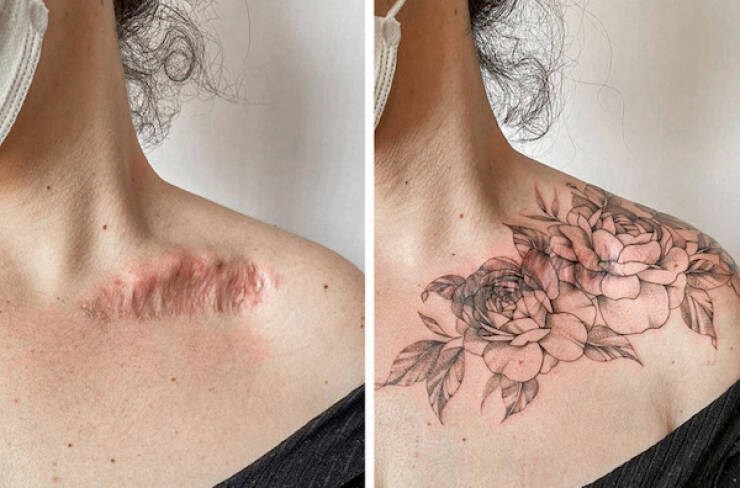 People Covering Their Scars In Cool Fashion