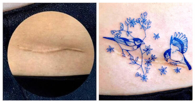 People Covering Their Scars In Cool Fashion