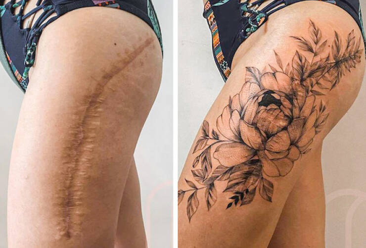 People Covering Their Scars In Cool Fashion