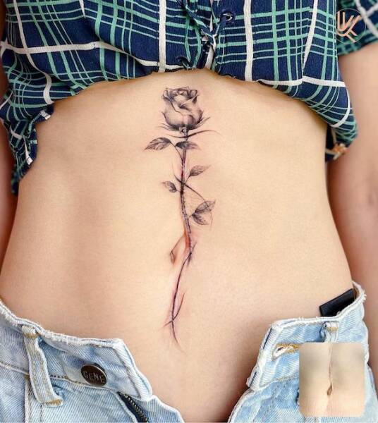 People Covering Their Scars In Cool Fashion