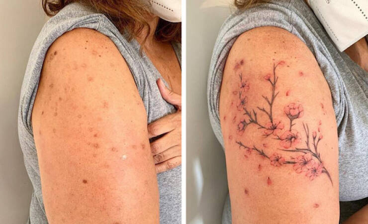 People Covering Their Scars In Cool Fashion