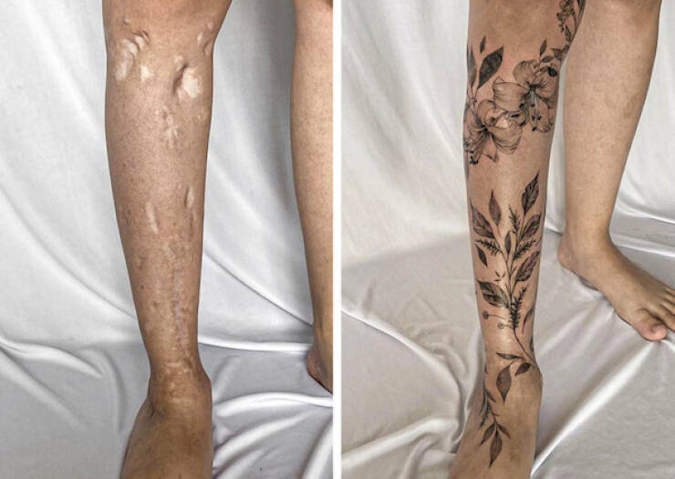 People Covering Their Scars In Cool Fashion