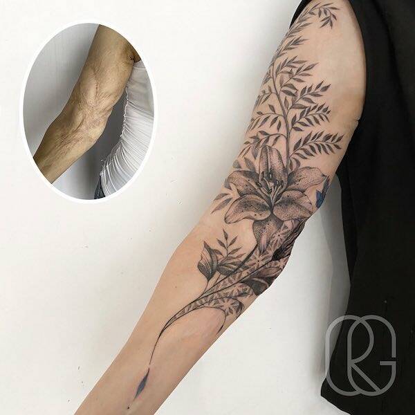 People Covering Their Scars In Cool Fashion