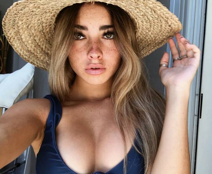 Girls Who Were Kissed By The Sun