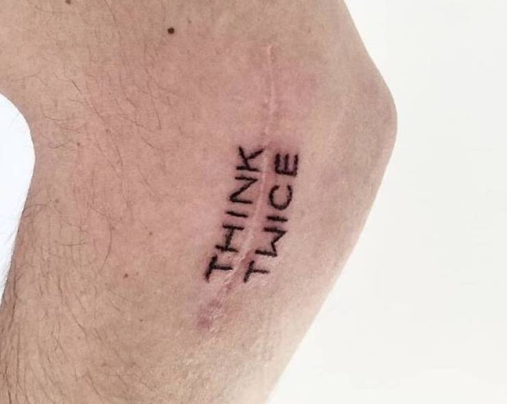 Tattoo Artists Covering Scars And Birthmarks