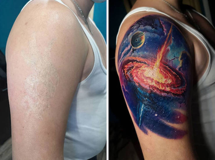 Tattoo Artists Covering Scars And Birthmarks