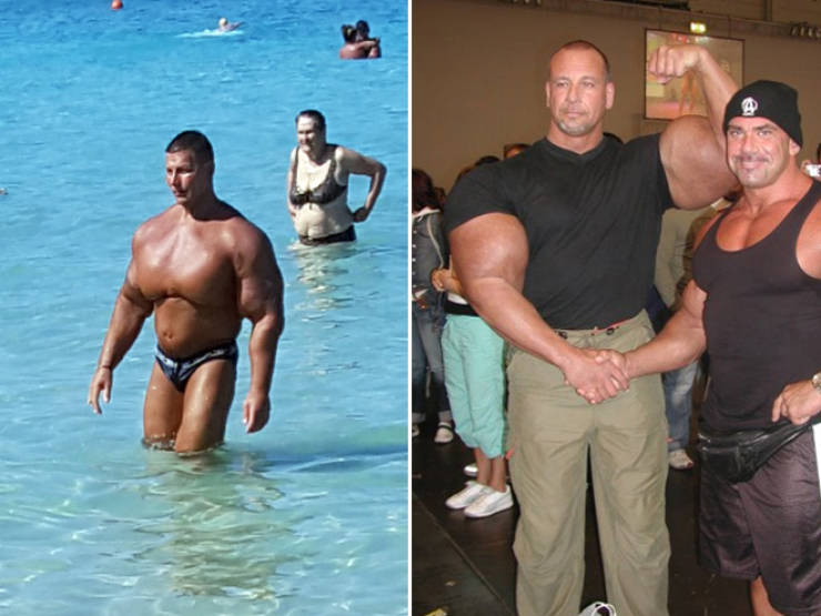 Synthol Does NOT Look Good, Guys…