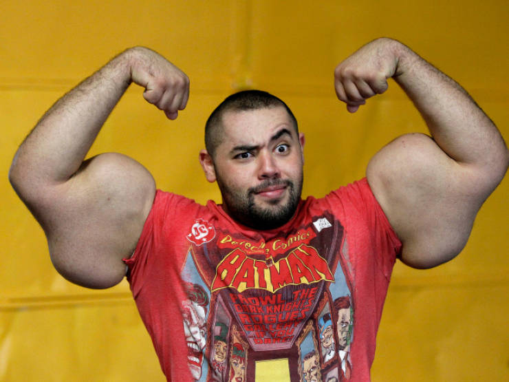 Synthol Does NOT Look Good, Guys…