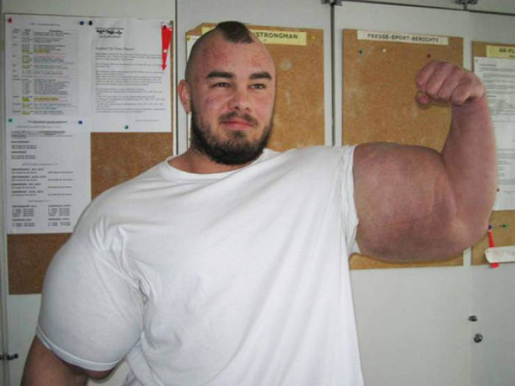 Synthol Does NOT Look Good, Guys…