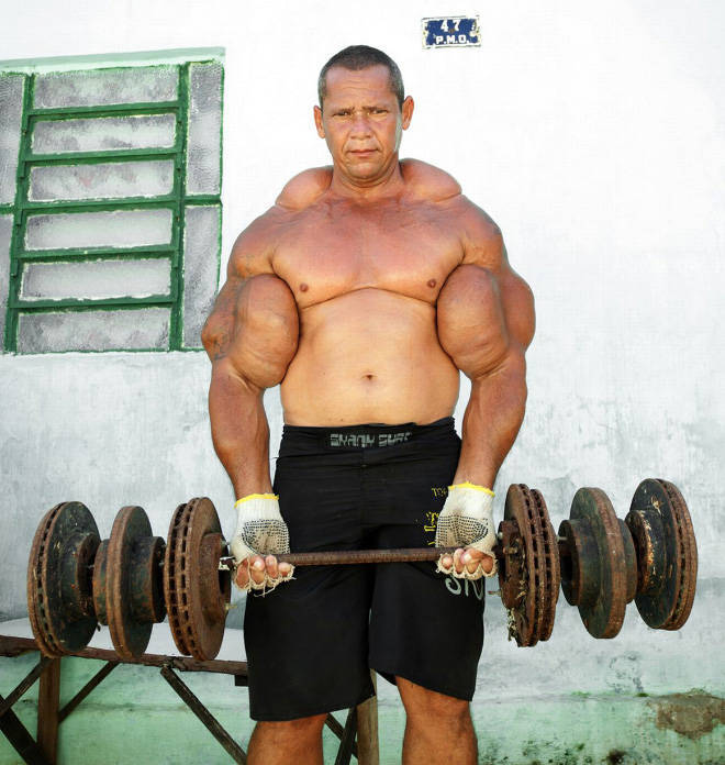 Synthol Does NOT Look Good, Guys…