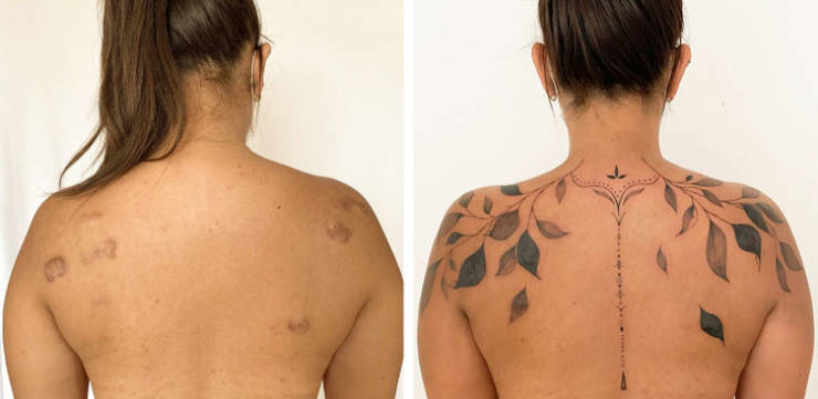 Artist Saves People’s Scars By Tattooing Over Them