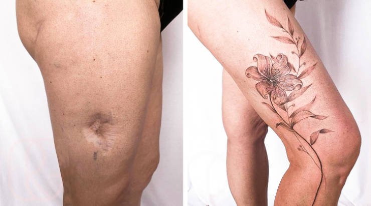 Artist Saves People’s Scars By Tattooing Over Them