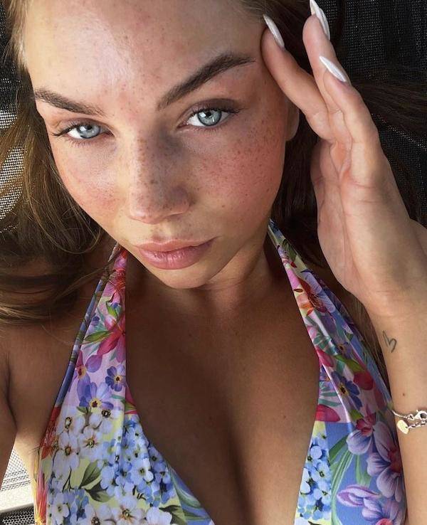 The Charm Of Freckled Faces