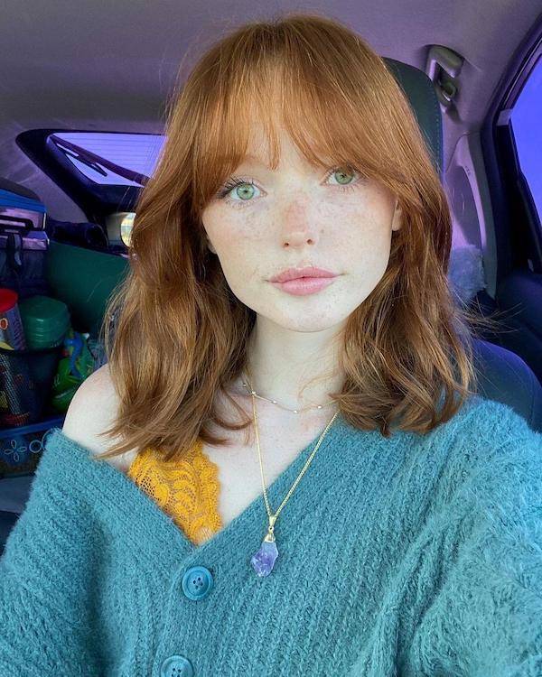 The Charm Of Freckled Faces