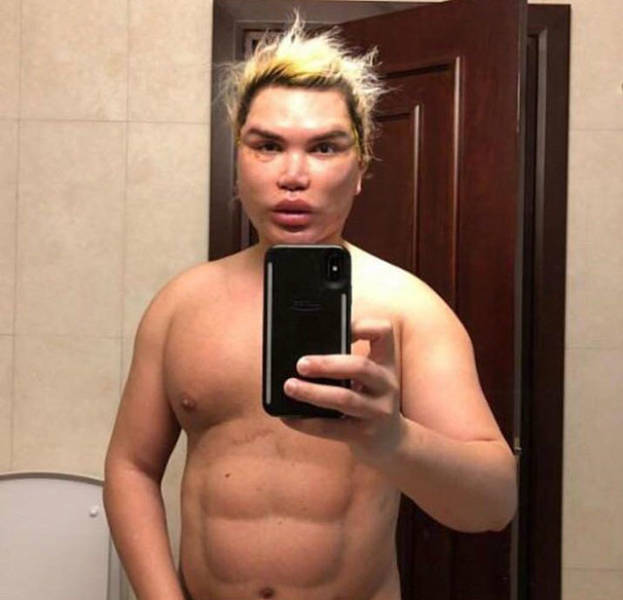 When Plastic Surgery Goes Too Far