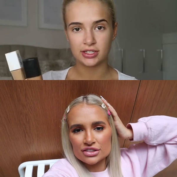 When Plastic Surgery Goes Too Far