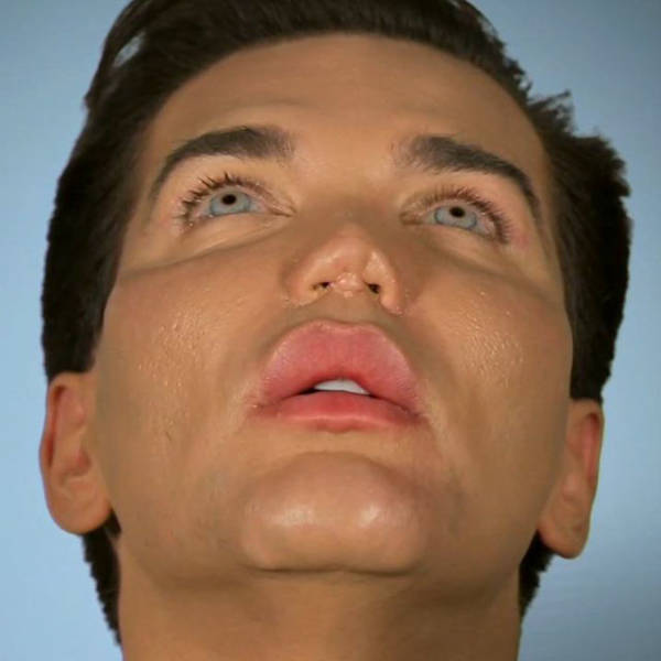 When Plastic Surgery Goes Too Far