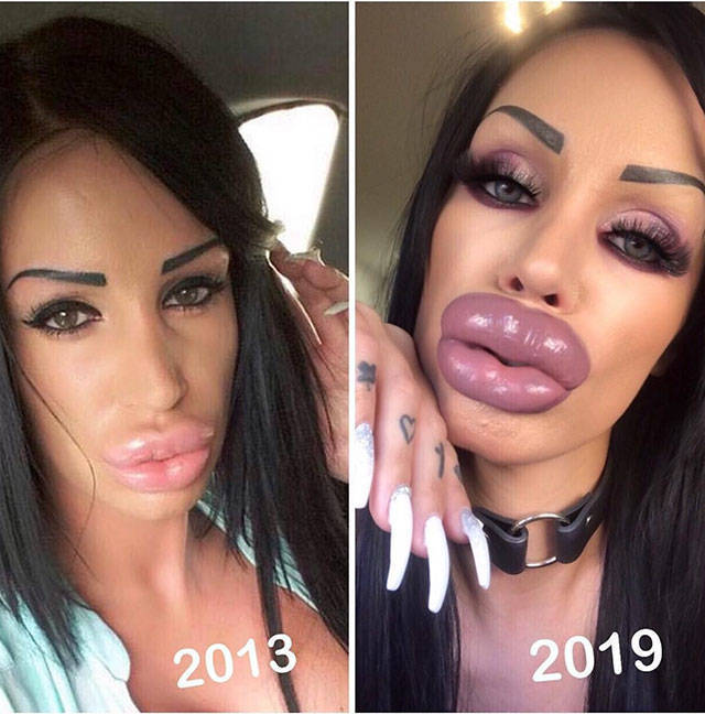 When Plastic Surgery Goes Too Far