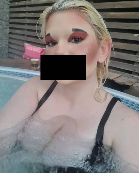 The Owner Of The Largest Lips In The World Wants To Increase Them Even More