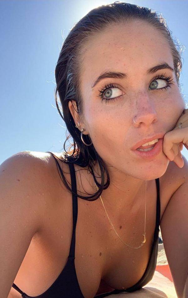 the charm of freckled faces 33 pics 2.html - 33 HD Photos | Premium Gallery 2023