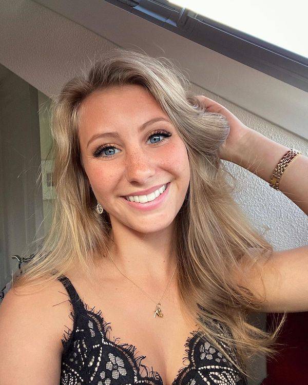 the charm of freckled faces 33 pics 2.html - 33 HD Photos | Premium Gallery 2023