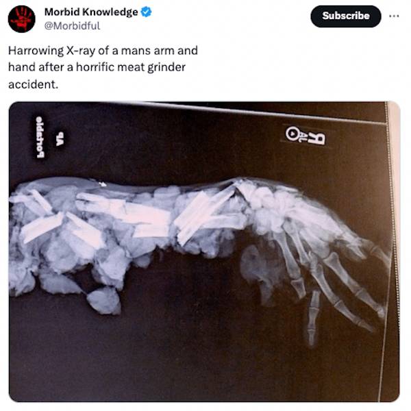 Unsettling Realities: Facts That Leave A Lasting Impression