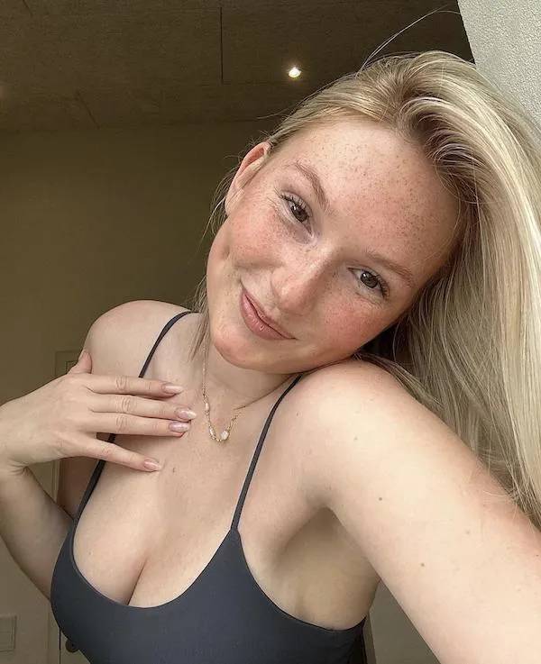 The Charm Of Freckled Faces