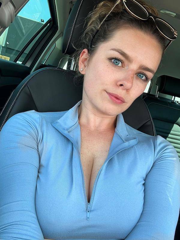 the charm of freckled faces 50 pics 22.html - 50 HD Photos | Premium Gallery 2024