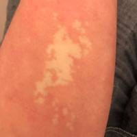 no bras anymore 44 pics 6.html - 44 HD Photos | Premium Gallery 2024